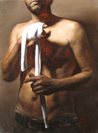 Wound